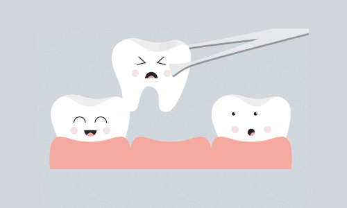 拔牙需谨慎！不注意可能会造成口腔伤害！