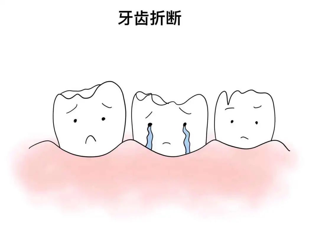 牙齿折断应该怎样处理