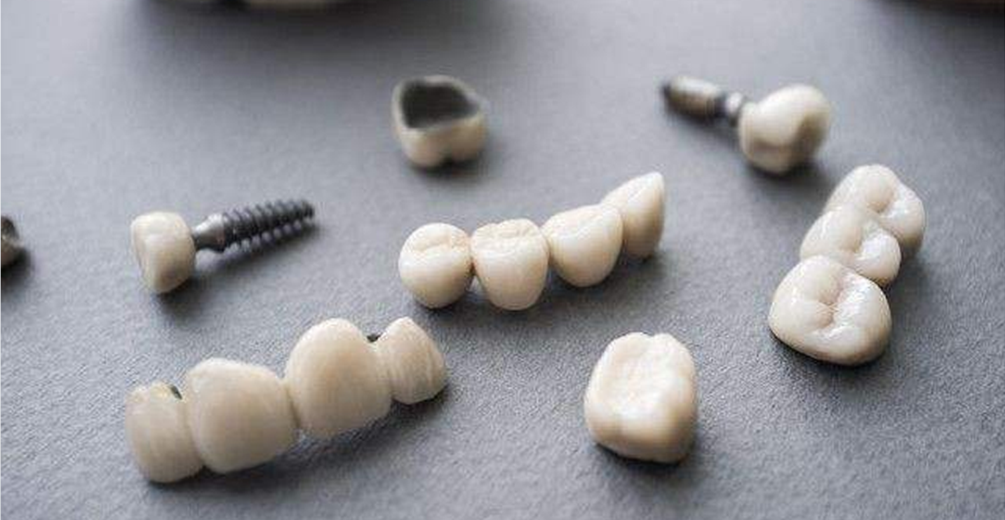 种植牙牙冠材质有哪些? 哪种牙冠好？