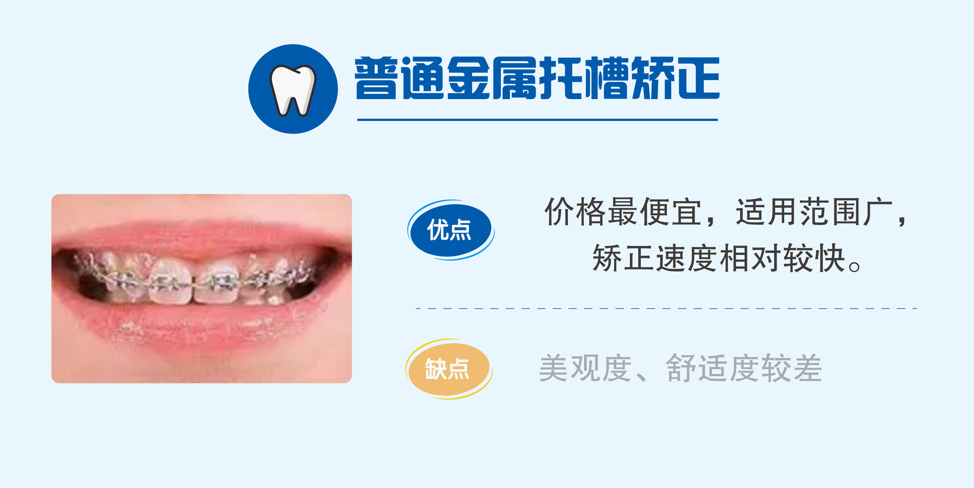 大连牙齿矫正多少钱？金属矫正7800元+隐形矫正16000元